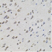 Immunohistochemistry of paraffin-embedded Rat brain using FoxO3a Antibody (1/100 dilution, 40x lens).