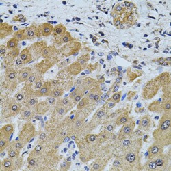 Forkhead Box Protein O3 (FOXO3) Antibody