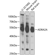 Western blot analysis of extracts of various cell lines using ADRA2A Antibody (1/1000 dilution).