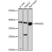 Western blot analysis of extracts of various cell lines using IFNGR2 Antibody (1/1000 dilution).