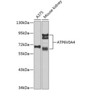 Western blot analysis of extracts of various cell lines using ATP6V0A4 Antibody (1/1000 dilution).