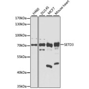 Western blot analysis of extracts of various cell lines using SETD3 Antibody (1/1000 dilution).