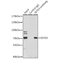 SET Domain Containing 3 (SETD3) Antibody