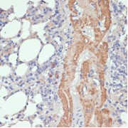 Immunohistochemistry of paraffin-embedded Rat lung using WNT5B Antibody (1/100 dilution, 40x lens).