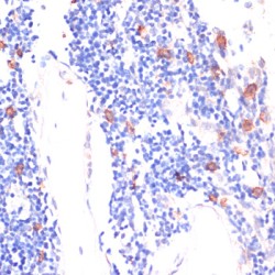 Protein Wnt-5b (WNT5B) Antibody