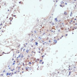 Protein Wnt-5b (WNT5B) Antibody