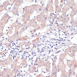 Protein Wnt-5b (WNT5B) Antibody
