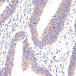 Protein Wnt-5b (WNT5B) Antibody