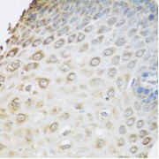 Immunohistochemistry of paraffin-embedded Human esophagus using GRPEL2 Antibody (1/100 dilution, 40x lens).
