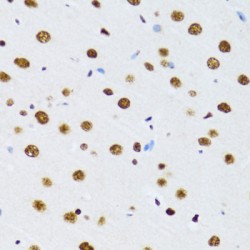 DExD-Box Helicase 39B (DDX39B) Antibody