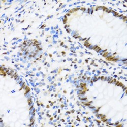 DExD-Box Helicase 39B (DDX39B) Antibody