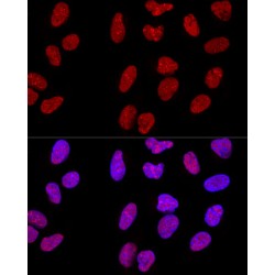 N6-Adenosine-Methyltransferase Catalytic Subunit (METTL3) Antibody