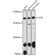 Western blot analysis of extracts of various cell lines using CFTR Antibody (1/1000 dilution).