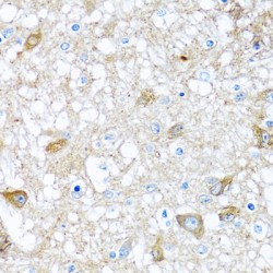 Bone Morphogenetic Protein 5 (BMP5) Antibody