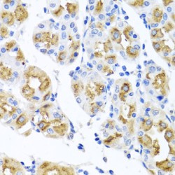 Ferrochelatase (FECH) Antibody