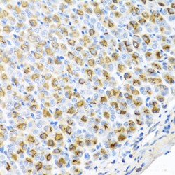 Ferrochelatase (FECH) Antibody