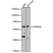 Western blot analysis of extracts of various cell lines using CHRNA6 Antibody (1/1000 dilution).