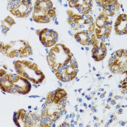 Receptor Interacting Serine/threonine Kinase 4 (RIPK4) Antibody