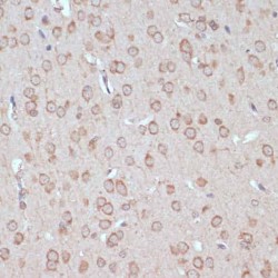 Yes-Associated Protein 1 (YAP1) Antibody