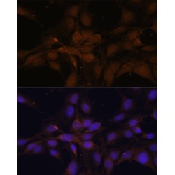 Yes-Associated Protein 1 (YAP1) Antibody