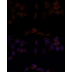 Yes-Associated Protein 1 (YAP1) Antibody