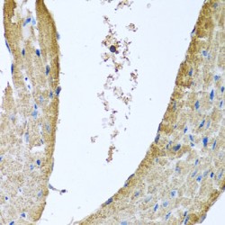 Cytochrome C Oxidase Subunit 5B (COX5B) Antibody