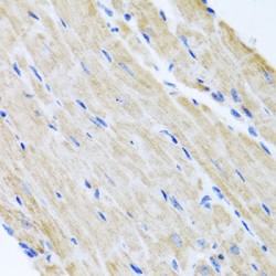 ATP Binding Cassette Transporter B8 (ABCB8) Antibody
