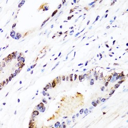 Fibroblast Growth Factor 12 (FGF12) Antibody
