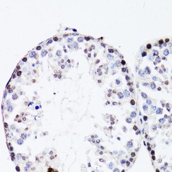 Fibroblast Growth Factor 12 (FGF12) Antibody