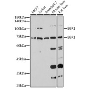 Western blot analysis of extracts of various cell lines using EGR1 Antibody (1/1000 dilution).