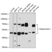 Western blot analysis of extracts of various cells using Heparanase 1 Antibody (1/1000 dilution).