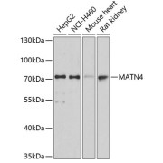 Western blot analysis of extracts of various cell lines using MATN4 Antibody (1/3000 dilution).