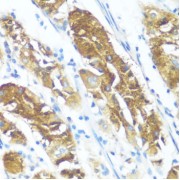 Immunohistochemistry of paraffin-embedded Human stomach using NME3 Antibody (1/100 dilution, 40x lens).