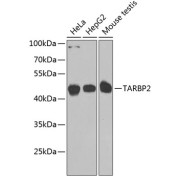 Western blot analysis of extracts of various cell lines using TARBP2 Antibody (1/1000 dilution).