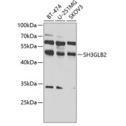 Western blot analysis of extracts of various cell lines using SH3GLB2 Antibody (1/1000 dilution).