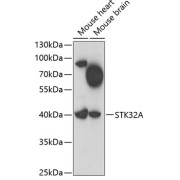 Western blot analysis of extracts of various cell lines using STK32A Antibody (1/1000 dilution).