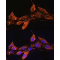 ADP-Ribosylation Factor 4 (ARF4) Antibody