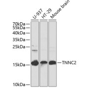 Western blot analysis of extracts of various cell lines using TNNC2 Antibody (1/1000 dilution).