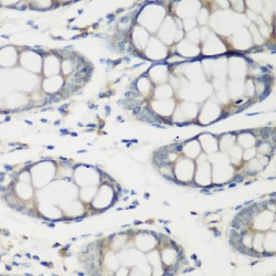 Troponin C Type 2 (TNNC2) Antibody