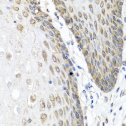 Angiopoietin-1 (ANGPT1) Antibody