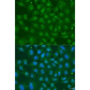 Immunofluorescence analysis of U2OS cells using ZBTB20 Antibody (1/100 dilution). Blue: DAPI for nuclear staining.