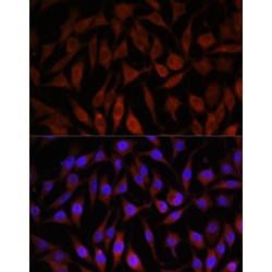 E3 Ubiquitin-Protein Ligase NEDD4-Like (NEDD4L) Antibody
