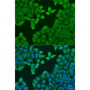 Immunofluorescence analysis of U2OS cells using ARF3 Antibody (1/100 dilution). Blue: DAPI for nuclear staining.