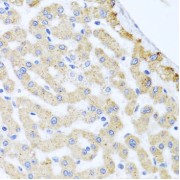 Immunohistochemistry of paraffin-embedded Human liver damage using CETN3 Antibody (1/100 dilution, 40x lens).