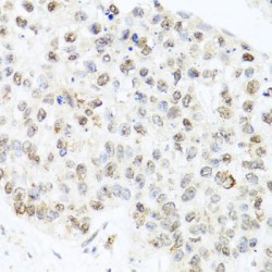 Centrin-3 (CETN3) Antibody