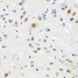 Centrin-3 (CETN3) Antibody