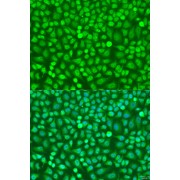 Immunofluorescence analysis of U2OS cells using HOXB5 Antibody (1/100 dilution). Blue: DAPI for nuclear staining.