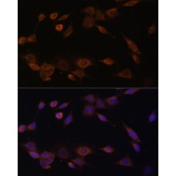 NADPH-Cytochrome P450 Reductase (POR) Antibody