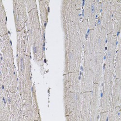 Solute Carrier Family 2, Facilitated Glucose Transporter Member 3 (SLC2A3) Antibody