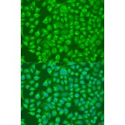 Immunofluorescence analysis of U2OS cells using SLC12A6 Antibody (1/100 dilution). Blue: DAPI for nuclear staining.